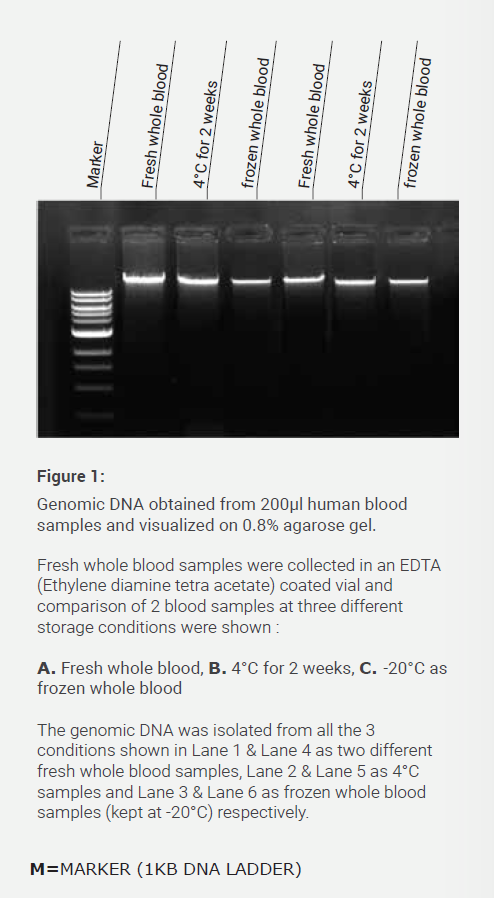DNA Bioanalyzer
