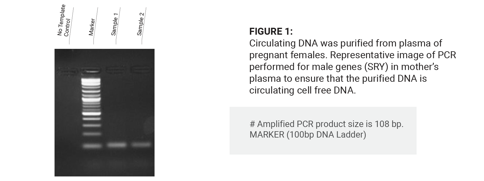 DNA Bioanalyzer