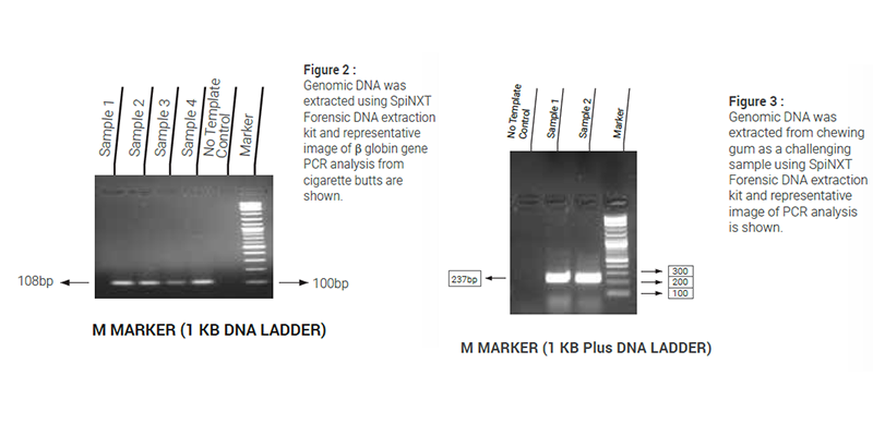 DNA Bioanalyzer