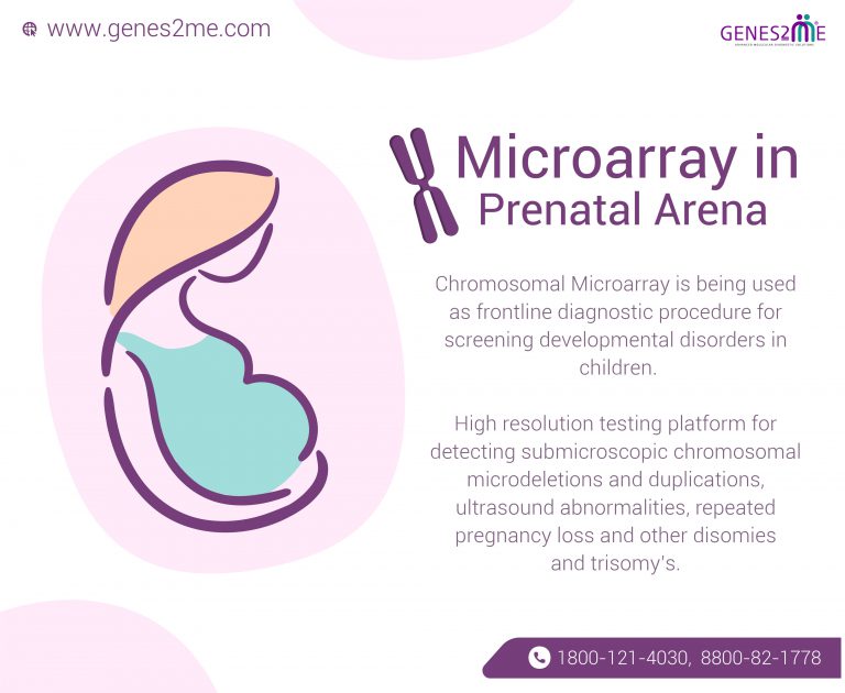 Microarray testing diagnositc tool used in Prenatal diagnosis