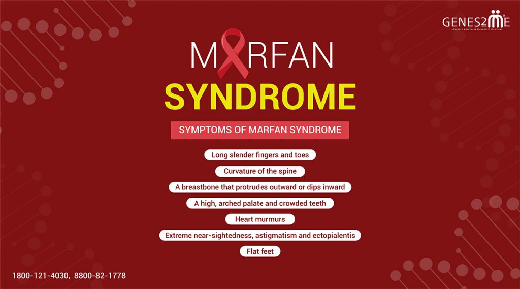 Marfan Syndrome Awareness Month February - Diagnosis, Genetic Testing