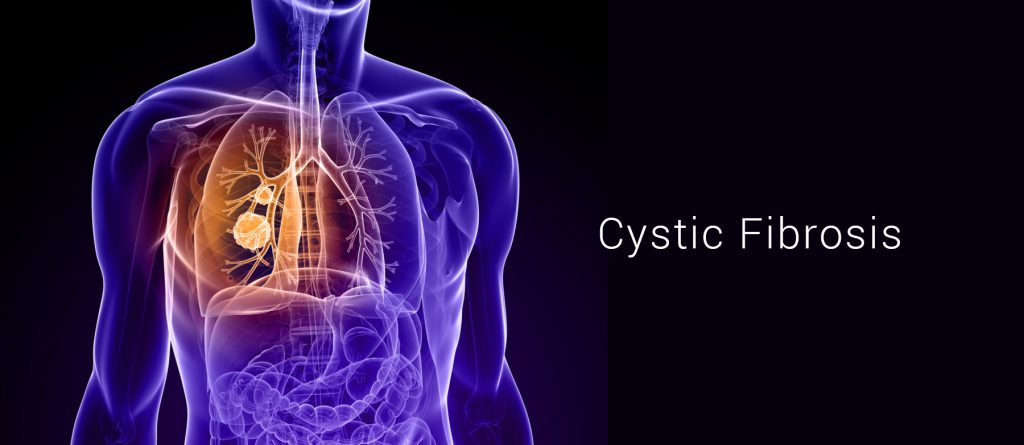 Cystic Fibrosis Disease