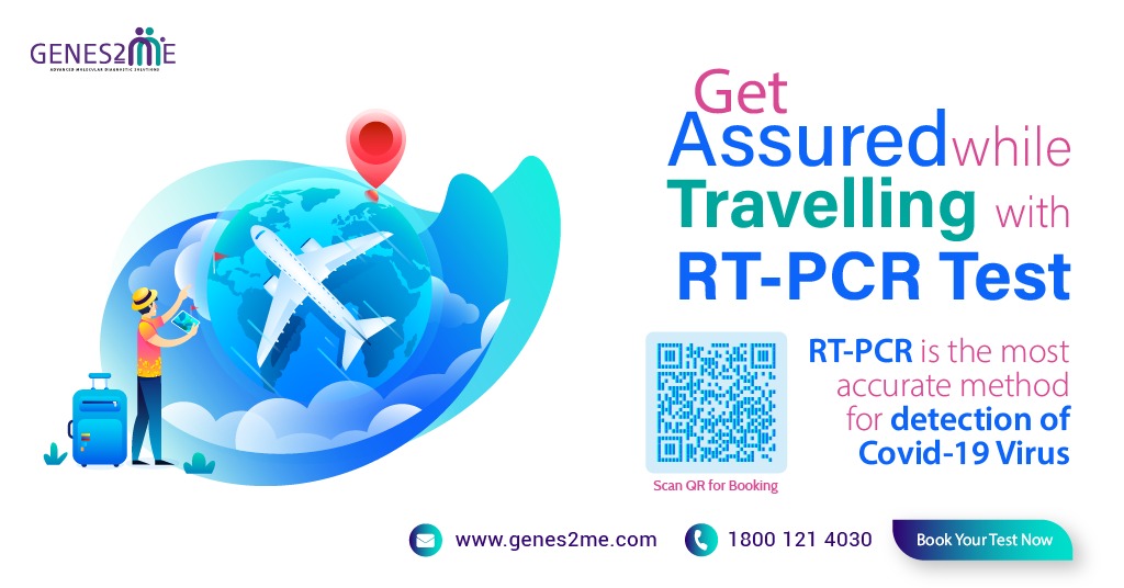 rt pcr test for travel cvs