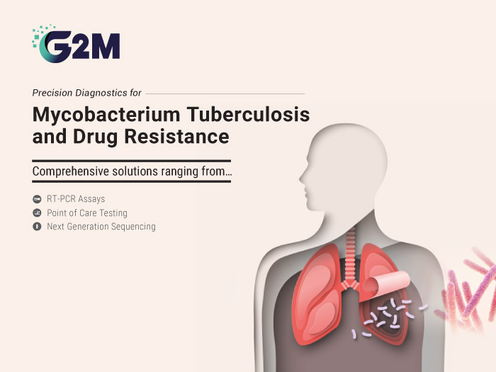 Diagnostic Ecosystem for TB Control