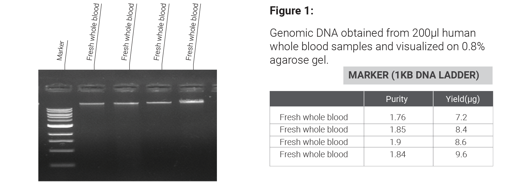 Blood DNA Extraction Kit